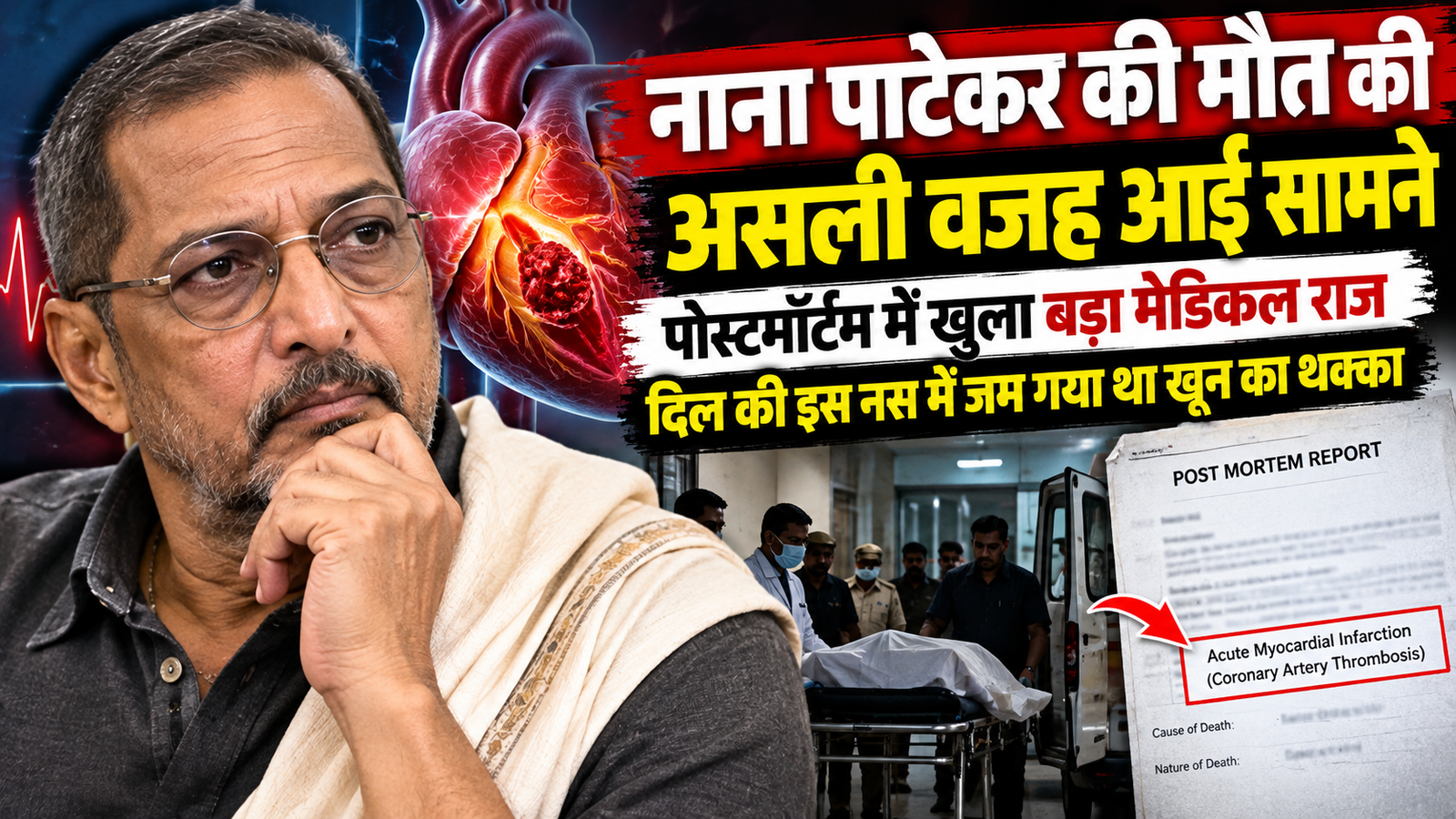 नाना पाटेकर की मौत की असली वजह आई सामने, पोस्टमॉर्टम में खुला बड़ा मेडिकल राज; दिल की इस नस में जम गया था खून का थक्का